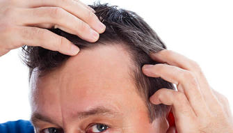 7 Tips to Reduce Gray Hair